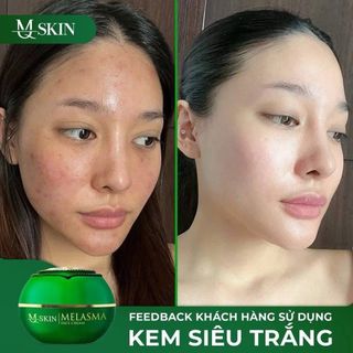 Kem dưỡng trắng mqskin