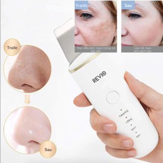 Máy chà mụn đầu đen 4 trong 1 loại bỏ mụn đầu đen, làm sạch sâu và săn chắc da mặt - Skincare