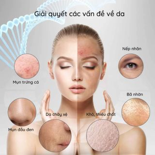 Máy chà mụn đầu đen 4 trong 1 loại bỏ mụn đầu đen, làm sạch sâu và săn chắc da mặt - Skincare