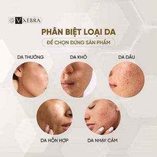[CHÍNH HÃNG] VXEBRA ORICO CLEANSER - Sữa rửa mặt làm sạch da, tẩy tế bào chết