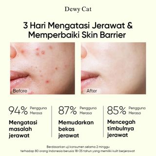 Serum làm sáng da Dewy Cat Salicylic Acid đặc trị mụn , loại bỏ nhờn chuyên sâu