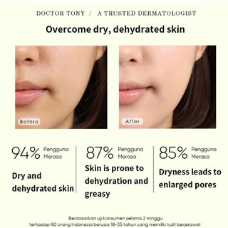 Nước hoa hồng Dorctor tony4D Hyaluronic Acid Toner