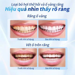Kem đánh răng Nhật bản MUZOME