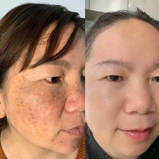 Viên collagen thoa đẹp da korea