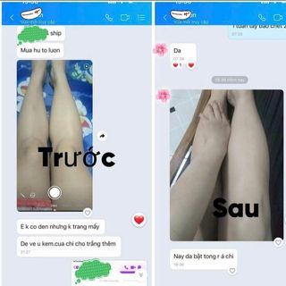Kem trắng da body cấp tốc