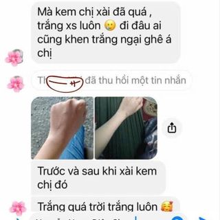 Kem trắng da body cấp tốc