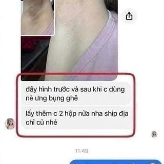 Kem trị thâm nách, mông, bẹn Gluta Milk (mua 1 hộp Tặng 1 tuýp