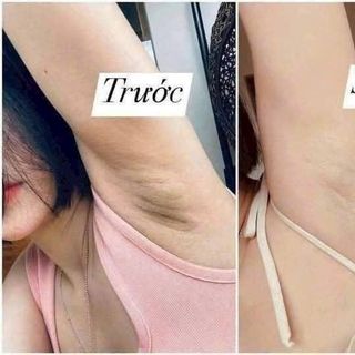 Kem trị thâm nách, mông, bẹn Gluta Milk (mua 1 hộp Tặng 1 tuýp