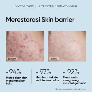 Sữa rửa mặt Der.J Niacinamide hương cam bưởi dưỡng ẩm chuyện sau, se khích lỗ chân lông, đồi mồi ( Hàng Gía Tận Xưởng)