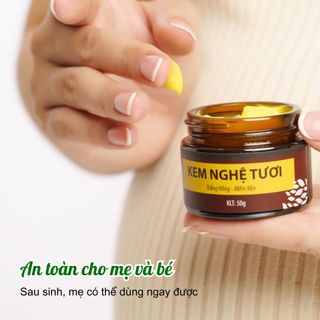 ✨ KEM NGHỆ TƯƠI WONMOM – Da trắng hồng, mềm mịn cho mẹ bầu & mẹ bỉm ✨
