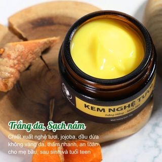 ✨ KEM NGHỆ TƯƠI WONMOM – Da trắng hồng, mềm mịn cho mẹ bầu & mẹ bỉm ✨