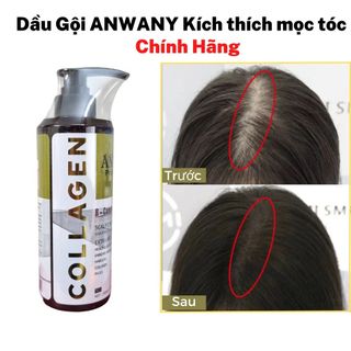 Dầu gội kích thích mọc tóc Anwany Collagen 500ml