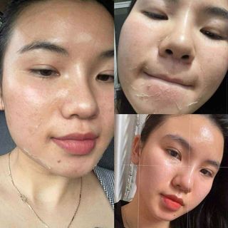 Serum HA, Phục Hồi, Cấp Ẩm, Căng Bóng, giúp sáng da sau peel, skincare