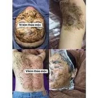BODY PEEL retinol giúp làm sáng, giảm thâm mông, nách, bikini, đầu gối, khuỷu tay, Giúp loại bỏ tế bào chết bên ngoài
