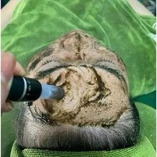 PEEL DA VI TẢO retinol CAO CẤP tẩy da chết giảm mụn thâm nám tàn nhang thay da sinh học Giúp loại bỏ tế bào chết bên ngoài