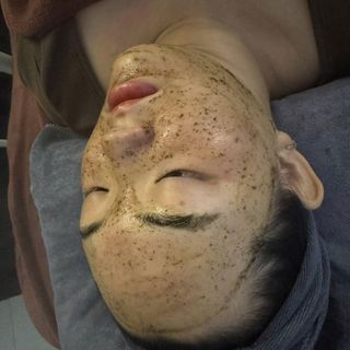 PEEL DA VI TẢO retinol CAO CẤP tẩy da chết giảm mụn thâm nám tàn nhang thay da sinh học Giúp loại bỏ tế bào chết bên ngoài