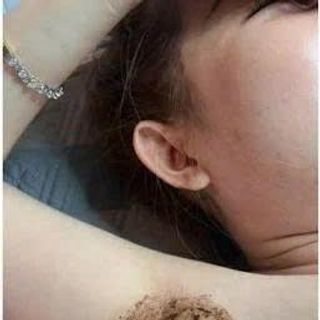 PEEL DA MẶT VI TẢO CAO CẤP tẩy da chết giảm mụn thâm nám tàn nhang thay da sinh học peel lột da retinol