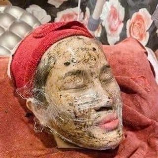 PEEL DA MẶT VI TẢO CAO CẤP tẩy da chết giảm mụn thâm nám tàn nhang thay da sinh học peel lột da retinol