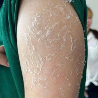 PEEL DA MẶT VI TẢO CAO CẤP tẩy da chết giảm mụn thâm nám tàn nhang thay da sinh học peel lột da retinol