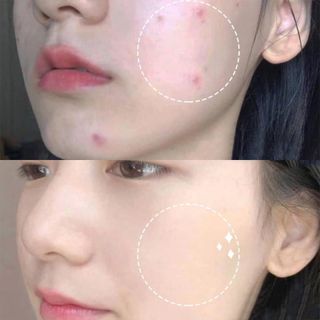 Nước Hoa Hồng Chiết Xuất Diếp Cá, Tía Tô Chinoshio Natural Skin Lotion