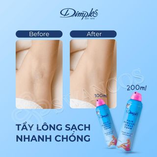Bọt tẩy lông Dimples hương hoa hồng dạng bọt dùng cho chân tay nách không gây kích ứng