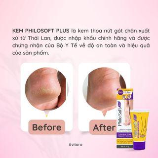 Kem thoa nứt gót chân Philosoft Plus Cream làm lành vết nứt, da chết và ngăn ngừa mồ hôi chân 50g chính hãng Thái Lan