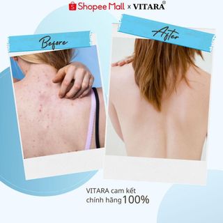 Xịt mụn lưng Vitara SE Body Acne Spray giảm mụn lưng, ngực, viêm nang lông giảm mụn mờ thâm sáng da 50ml chính hãng Thái