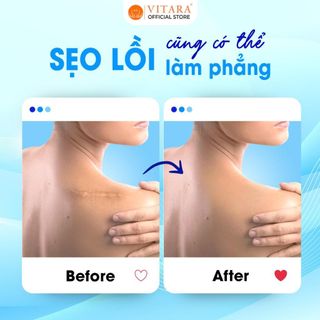 Kem mờ sẹo Vitara Ultra Silicone mờ sẹo lồi, sẹo phẩu thuật, sẹo lõm 9g