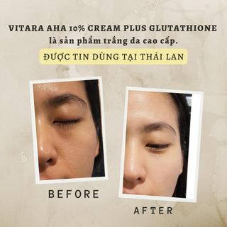 Kem dưỡng trắng da Vitara AHA 10% Cream Extra Plus có Glutathoine giúp da trắng sáng, mềm mịn 20g