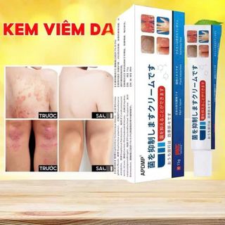 Kem trị viêm da APDIMP – Giảm ngứa, mẩn đỏ, nứt da hiệu quả | Kem bôi da Nhật Bản