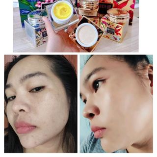 KEM FACE DEMEJINE CẢI THIỆN SAU 20DAY HIỆU QUẢ THỰC TẾ