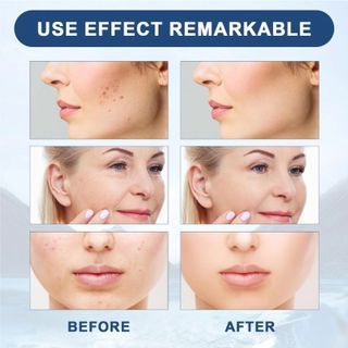 Huyết thanh NAD Ampoule cải thiện độ đàn hồi và độ săn chắc của da. Tinh chất Retinol Ampoule. bán chạy nhất xuyên biên giới ( Hnagf Gía Tận Xưởng)