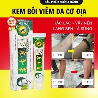 Kem bôi nấm ngứa nội địa trung