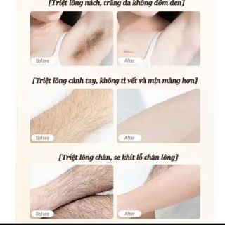 Kem wax lông sadoer