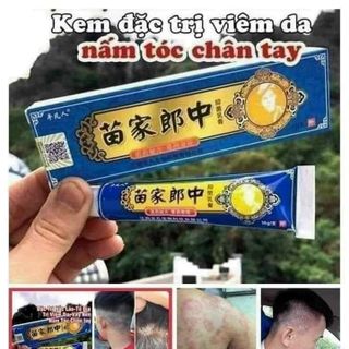 Kem Bôi Da Liễu Nấm Ngứa Xanh Dương Ông Lão