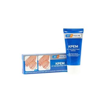 Kem Dưỡng Làm Mờ Phục Hồi Đốm Nâu Đồi Mồi Kpem Cream 50g