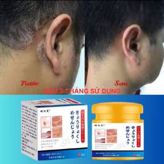 Kem bôi nấm ngứa Nhật Bản hũ 20gr