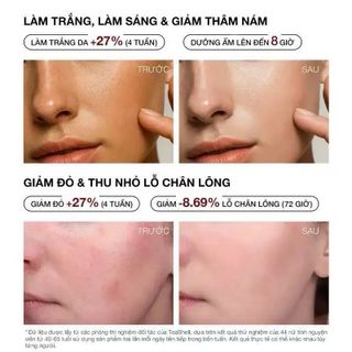 Tinh chất Niacinamide - dưỡng ẩm, làm dịu, làm sáng da và làm đều màu da