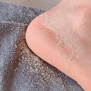 CHÀ GÓT DÙNG ĐƯỢC 2 MẶT, CHÂN ÁI CHO MỌI NGƯỜI