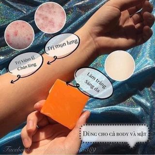XÀ PHÒNG CÁM NGHỆ TRẮNG DA, HỖ TRỢ GIẢM MỤN HIỆU QUẢ