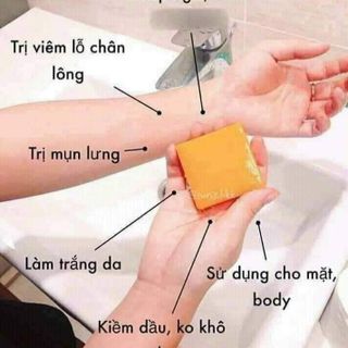 XÀ PHÒNG CÁM NGHỆ TRẮNG DA, HỖ TRỢ GIẢM MỤN HIỆU QUẢ
