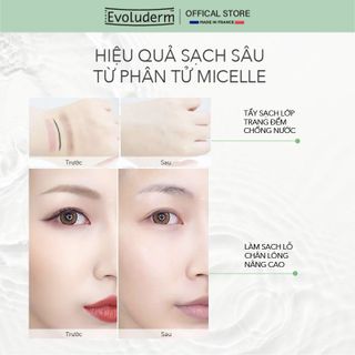 Nước tẩy trang thiên nhiên thuần chay Evoluderm dành cho da dầu mụn hỗn hợp 250ml (HSD 06/2027)