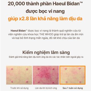 Tinh chất tuần hoàn Bichup Treatment Essence mini 15ml giúp kích thích tuần hoàn khí huyết, tăng sinh khí, giảm mẫn đỏ