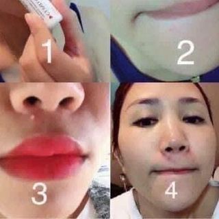 Chấm mụn Clinda-M TL 15ml