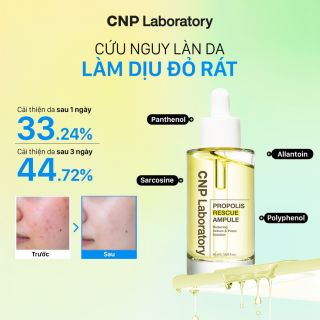 Tinh Chất keo ong Cho Da Dầu Mụn