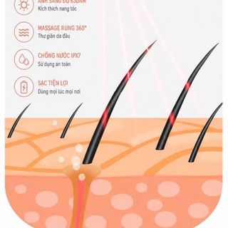 Máy Massage Da Đầu Cầm Tay 4 Đầu Silicone Mềm – Chống Nước – Sạc Type-C – Thư Giãn Toàn Diện