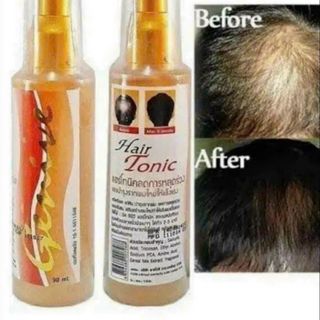 Xịt trị hói Genive 120ml