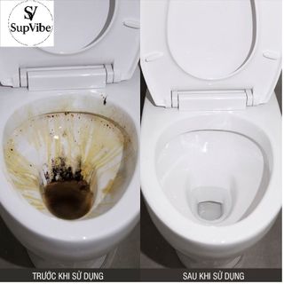 Tẩy Cặn Canxi Supvibe Loại 1