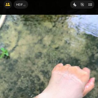 KEM NÂNG TÔNG DA
