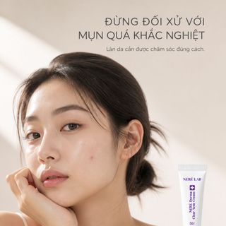 Kem Mụn Neré Derma Clear Acne Cream 5g Hỗ Trợ Giảm Mụn Làm Dịu Da Cho Da Mụn